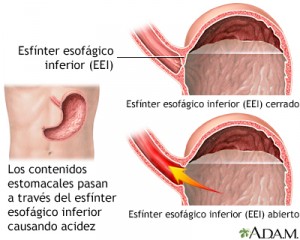 Esfínter anormal