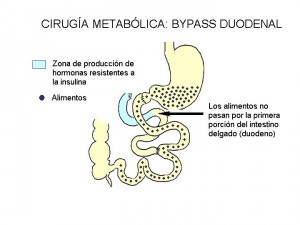 diagrama2